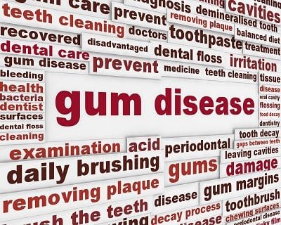 treating gum disease Orange County