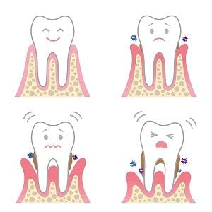 gum disease orange county
