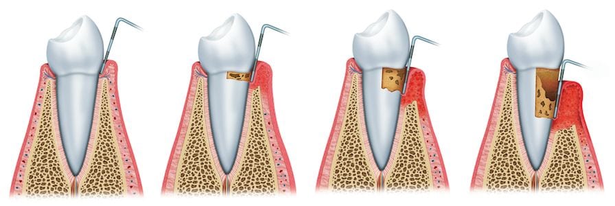 Periodontics Orange County
