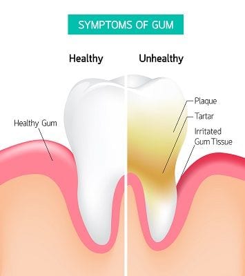 Ladera Ranch Dentist Orange County