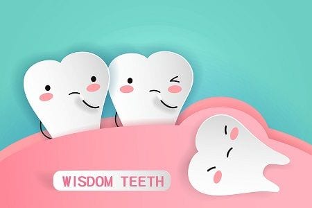 Orange County Wisdom teeth removal