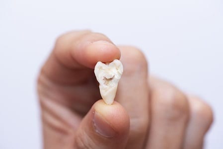 Orange County oral surgery