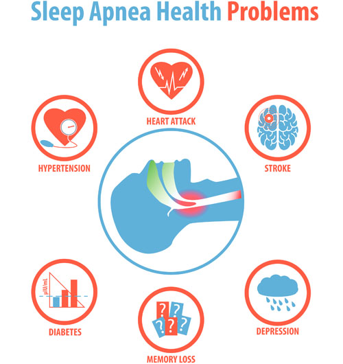 Image result for Why Prioritize Sleep Apnea Treatment? infographics