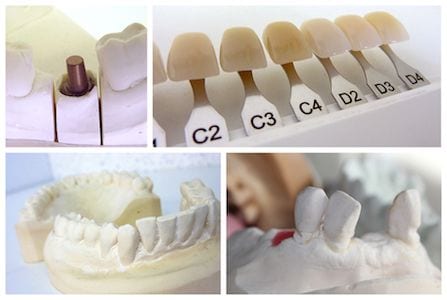 Anaheim Cosmetic Dentistry
