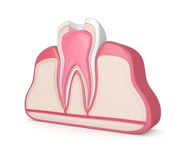Laguna Woods Root Canal Treatment Mission Viejo