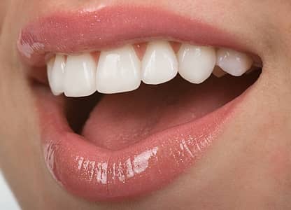 Anaheim Veneers Orange County